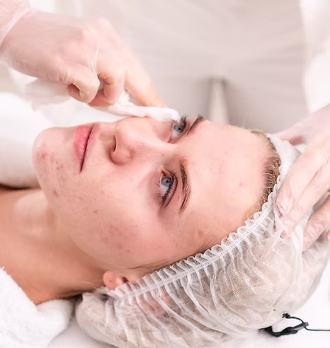 tratamientos faciales personalizados Sevilla