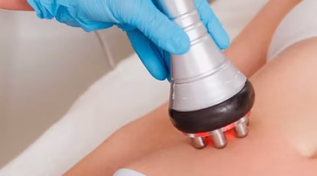 radiofrecuencia corporal para reafirmación